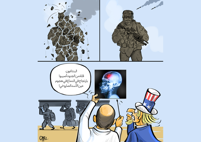 كاريكاتير/ إصابات خفيفة بارتجاج في الدماغ!